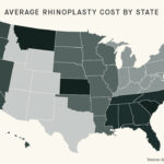 Rhinoplasty Average Procedure Costs By State